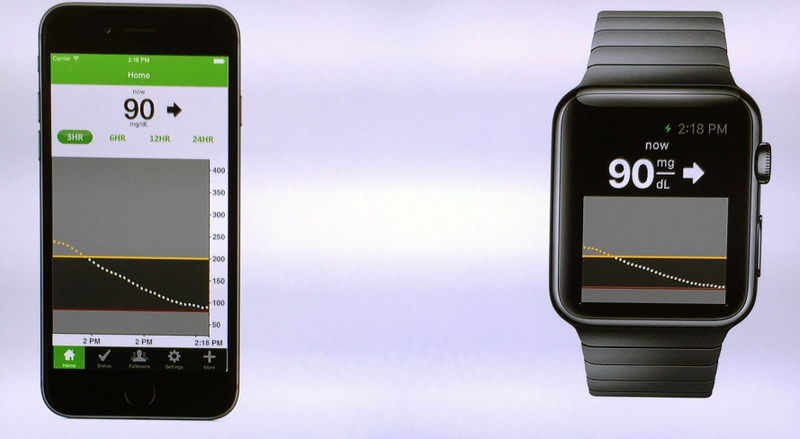 Illustration for article titled The Apple Watch Will Bring Glucose Tracking to Your Wrist